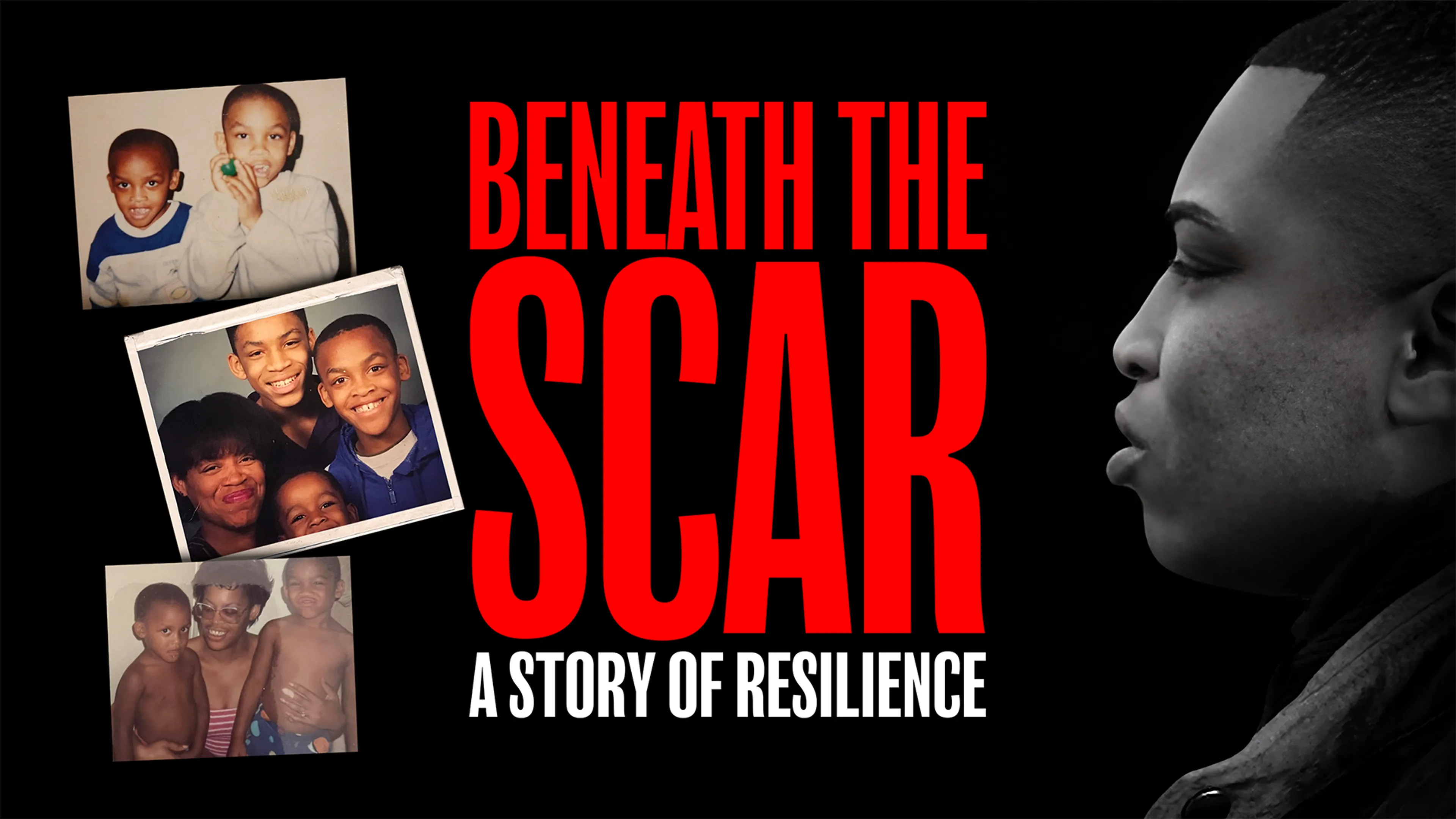 Beneath the Scar: A Story of Resilience poster